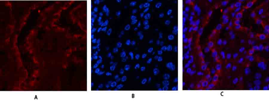 Fig.1. Immunofluorescence analysis of mouse kidney tissue. 1, ERβ Polyclonal Antibody (red) was diluted at 1:200 (4°,overnight). 2, Cy3 Labeled secondary antibody was diluted at 1:300 (room temperature, 50min). 3, Picture B: DAPI (blue) 10min. Picture A: Target. Picture B: DAPI. Picture C: merge of A+B.