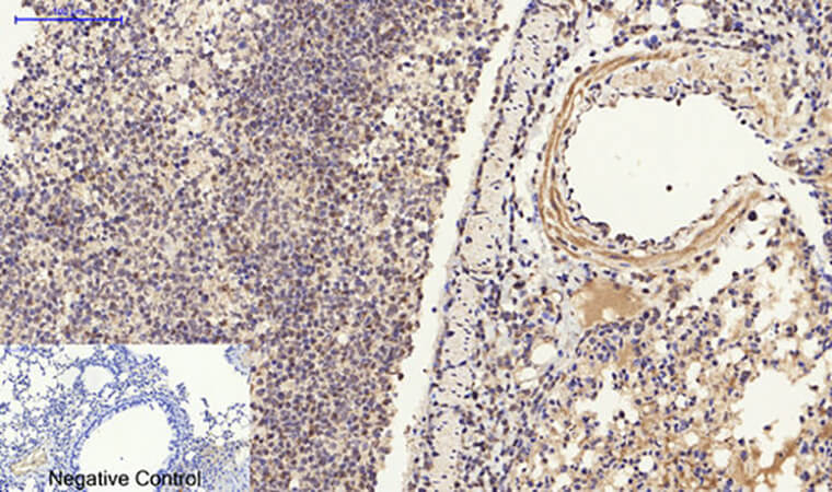 Fig.4. Immunohistochemical analysis of paraffin-embedded mouse lung tissue. 1, ERβ Polyclonal Antibody was diluted at 1:200 (4°C, overnight). 2, Sodium citrate pH 6.0 was used for antibody retrieval (>98°C, 20min). 3, secondary antibody was diluted at 1:200 (room temperature, 30min). Negative control was used by secondary antibody only.