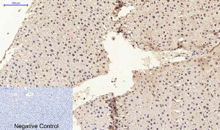 Fig.5. Immunohistochemical analysis of paraffin-embedded rat liver tissue. 1, ERβ Polyclonal Antibody was diluted at 1:200 (4°C, overnight). 2, Sodium citrate pH 6.0 was used for antibody retrieval (>98°C, 20min). 3, secondary antibody was diluted at 1:200 (room temperature, 30min). Negative control was used by secondary antibody only.