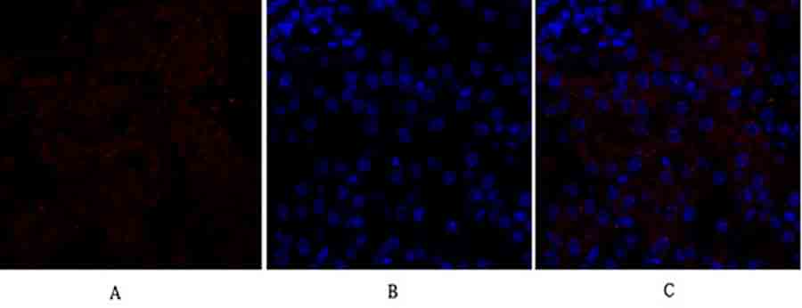 Fig.2. Immunofluorescence analysis of mouse kidney tissue. 1, Flk-1 Polyclonal Antibody (red) was diluted at 1:200 (4°C, overnight). 2, Cy3 Labeled secondary antibody was diluted at 1:300 (room temperature, 50min). 3, Picture B: DAPI (blue) 10min. Picture A: Target. Picture B: DAPI. Picture C: merge of A+B.