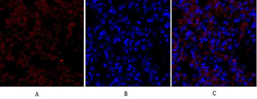 Fig.3. Immunofluorescence analysis of rat lung tissue. 1, Flk-1 Polyclonal Antibody (red) was diluted at 1:200 (4°C, overnight). 2, Cy3 Labeled secondary antibody was diluted at 1:300 (room temperature, 50min). 3, Picture B: DAPI (blue) 10min. Picture A: Target. Picture B: DAPI. Picture C: merge of A+B.