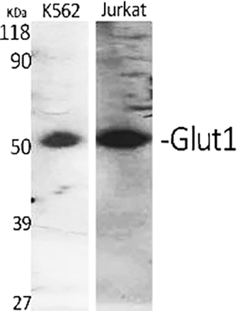 Fig.1. Western Blot analysis of K562 (1), Jukat (2), diluted at 1:500.