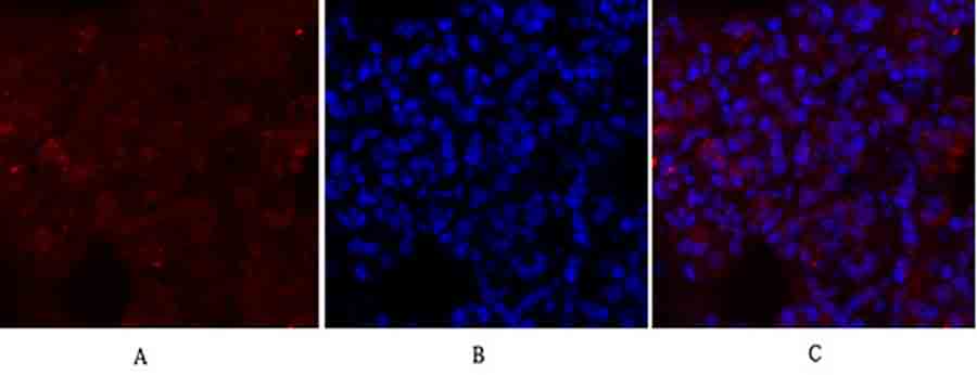 Fig.3. Immunofluorescence analysis of rat lung tissue. 1, Glut1 Polyclonal Antibody (red) was diluted at 1:200 (4°C, overnight). 2, Cy3 Labeled secondary antibody was diluted at 1:300 (room temperature, 50min). 3, Picture B: DAPI (blue) 10min. Picture A: Target. Picture B: DAPI. Picture C: merge of A+B.
