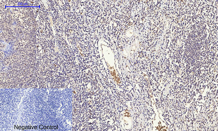 Fig.4. Immunohistochemical analysis of paraffin-embedded human tonsil tissue. 1, Glut1 Polyclonal Antibody was diluted at 1:200 (4°C, overnight). 2, Sodium citrate pH 6.0 was used for antibody retrieval (>98°C, 20min). 3, secondary antibody was diluted at 1:200 (room temperature, 30min). Negative control was used by secondary antibody only.