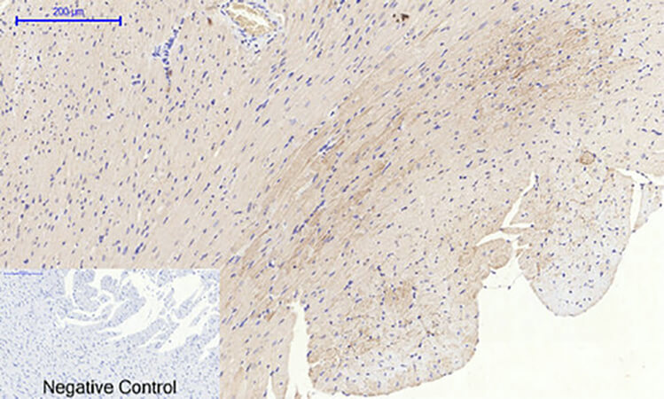 Fig.6. Immunohistochemical analysis of paraffin-embedded rat heart tissue. 1, Glut1 Polyclonal Antibody was diluted at 1:200 (4°C, overnight). 2, Sodium citrate pH 6.0 was used for antibody retrieval (>98°C, 20min). 3, secondary antibody was diluted at 1:200 (room temperature, 30min). Negative control was used by secondary antibody only.