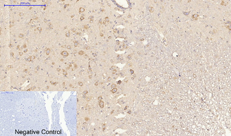 Fig.5. Immunohistochemical analysis of paraffin-embedded rat spinal cord tissue. 1, HSP A5 Polyclonal Antibody was diluted at 1:200 (4°C, overnight). 2, Sodium citrate pH 6.0 was used for antibody retrieval (>98°C, 20min). 3, secondary antibody was diluted at 1:200 (room temperature, 30min). Negative control was used by secondary antibody only.