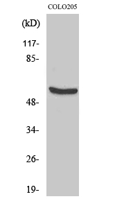 Fig.2. Western Blot analysis of COLO205 cells using HSP60 Polyclonal Antibody diluted at 1:2000.