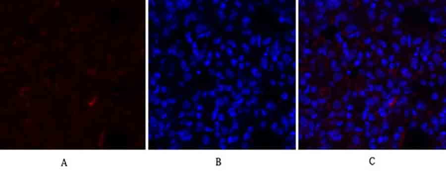 Fig.2. Immunofluorescence analysis of rat lung tissue. 1, IκB-α Polyclonal Antibody (red) was diluted at 1:200 (4°C, overnight). 2, Cy3 Labeled secondary antibody was diluted at 1:300 (room temperature, 50min). 3, Picture B: DAPI (blue) 10min. Picture A: Target. Picture B: DAPI. Picture C: merge of A+B.