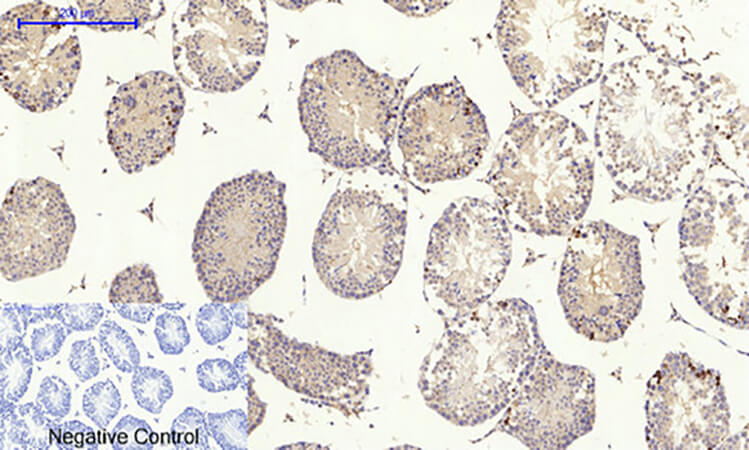Fig.4. Immunohistochemical analysis of paraffin-embedded mouse testis tissue. 1, IκB-α Polyclonal Antibody was diluted at 1:200 (4°C, overnight). 2, Sodium citrate pH 6.0 was used for antibody retrieval (>98°C, 20min). 3, secondary antibody was diluted at 1:200 (room temperature, 30min). Negative control was used by secondary antibody only.