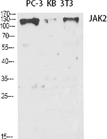 Fig.1. Western Blot analysis of PC-3 (1), KB (2), 3T3 (3), diluted at 1:2000.