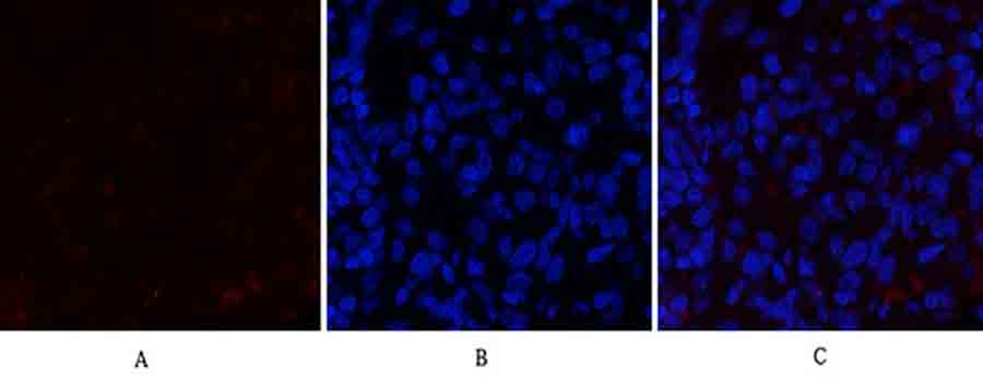 Fig.2. Immunofluorescence analysis of rat lung tissue. 1, JAK2 Polyclonal Antibody (red) was diluted at 1:200 (4°C, overnight). 2, Cy3 Labeled secondary antibody was diluted at 1:300 (room temperature, 50min). 3, Picture B: DAPI (blue) 10min. Picture A: Target. Picture B: DAPI. Picture C: merge of A+B.