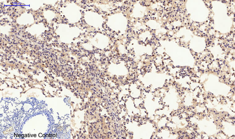 Fig.4. Immunohistochemical analysis of paraffin-embedded mouse lung tissue. 1, JAK2 Polyclonal Antibody was diluted at 1:200 (4°C, overnight). 2, Sodium citrate pH 6.0 was used for antibody retrieval (>98°C, 20min). 3, secondary antibody was diluted at 1:200 (room temperature, 30min). Negative control was used by secondary antibody only.