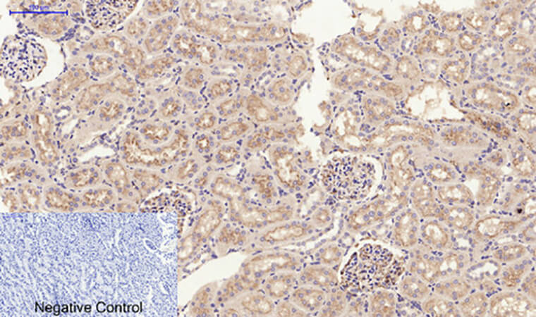 Fig.5. Immunohistochemical analysis of paraffin-embedded rat kidney tissue. 1, JAK2 Polyclonal Antibody was diluted at 1:200 (4°C, overnight). 2, Sodium citrate pH 6.0 was used for antibody retrieval (>98°C, 20min). 3, secondary antibody was diluted at 1:200 (room temperature, 30min). Negative control was used by secondary antibody only.
