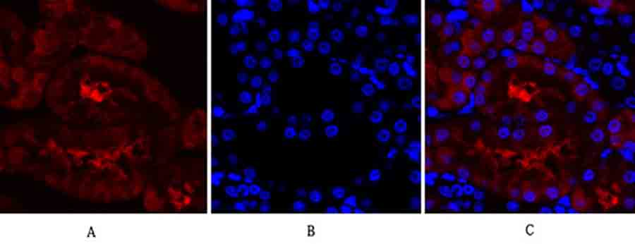 Fig.4. Immunofluorescence analysis of rat kidney tissue. 1, Lamin A/C Polyclonal Antibody (red) was diluted at 1:200 (4°C, overnight). 2, Cy3 Labeled secondary antibody was diluted at 1:300 (room temperature, 50min). 3, Picture B: DAPI (blue) 10min. Picture A: Target. Picture B: DAPI. Picture C: merge of A+B.