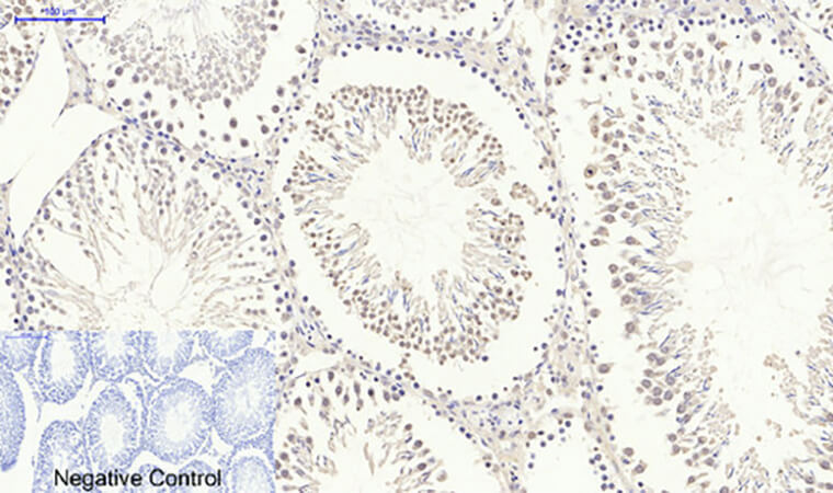 Fig.7. Immunohistochemical analysis of paraffin-embedded rat testis tissue. 1, Lamin A/C Polyclonal Antibody was diluted at 1:200 (4°C, overnight). 2, Sodium citrate pH 6.0 was used for antibody retrieval (>98°C, 20min). 3, secondary antibody was diluted at 1:200 (room temperature, 30min). Negative control was used by secondary antibody only.