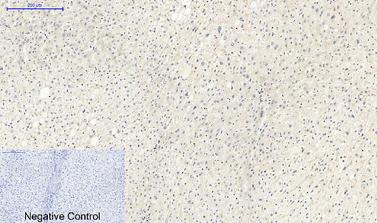 Fig.4. Immunohistochemical analysis of paraffin-embedded human liver tissue. 1, Lamin B1 Polyclonal Antibody was diluted at 1:200 (4°C, overnight). 2, Sodium citrate pH 6.0 was used for antibody retrieval (>98°C, 20min). 3, secondary antibody was diluted at 1:200 (room temperature, 30min). Negative control was used by secondary antibody only.