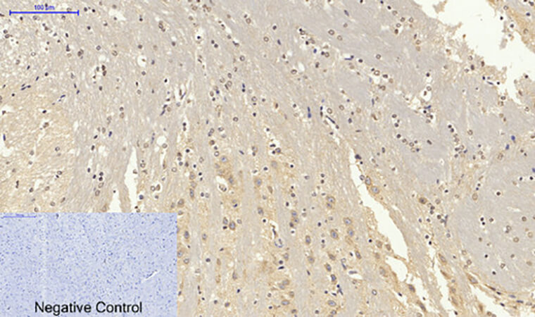 Fig.5. Immunohistochemical analysis of paraffin-embedded mouse brain tissue. 1, Lamin B1 Polyclonal Antibody was diluted at 1:200 (4°C, overnight). 2, Sodium citrate pH 6.0 was used for antibody retrieval (>98°C, 20min). 3, secondary antibody was diluted at 1:200 (room temperature, 30min). Negative control was used by secondary antibody only.