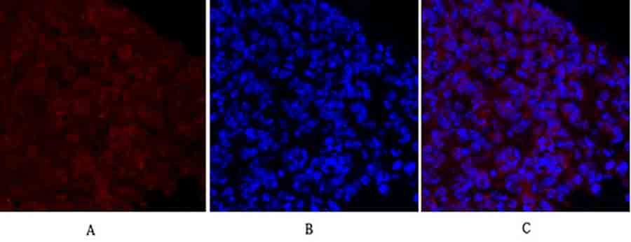 Fig.2. Immunofluorescence analysis of mouse lung tissue. 1, MEK-1/2 Polyclonal Antibody (red) was diluted at 1:200 (4°C, overnight). 2, Cy3 Labeled secondary antibody was diluted at 1:300 (room temperature, 50min). 3, Picture B: DAPI (blue) 10min. Picture A: Target. Picture B: DAPI. Picture C: merge of A+B.