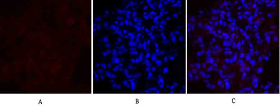 Fig.3. Immunofluorescence analysis of rat lung tissue. 1, MEK-1/2 Polyclonal Antibody (red) was diluted at 1:200 (4°C, overnight). 2, Cy3 Labeled secondary antibody was diluted at 1:300 (room temperature, 50min). 3, Picture B: DAPI (blue) 10min. Picture A: Target. Picture B: DAPI. Picture C: merge of A+B.