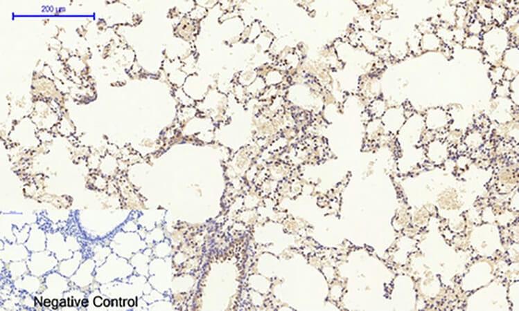Fig.6. Immunohistochemical analysis of paraffin-embedded rat lung tissue. 1, MEK-1/2 Polyclonal Antibody was diluted at 1:200 (4°C, overnight). 2, Sodium citrate pH 6.0 was used for antibody retrieval (>98°C, 20min). 3, secondary antibody was diluted at 1:200 (room temperature, 30min). Negative control was used by secondary antibody only.