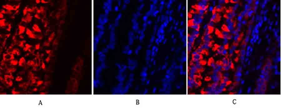 Fig.3. Immunofluorescence analysis of rat lung tissue. 1, MMP-2 Polyclonal Antibody (red) was diluted at 1:200 (4°C, overnight). 2, Cy3 Labeled secondary antibody was diluted at 1:300 (room temperature, 50min). 3, Picture B: DAPI (blue) 10min. Picture A: Target. Picture B: DAPI. Picture C: merge of A+B.