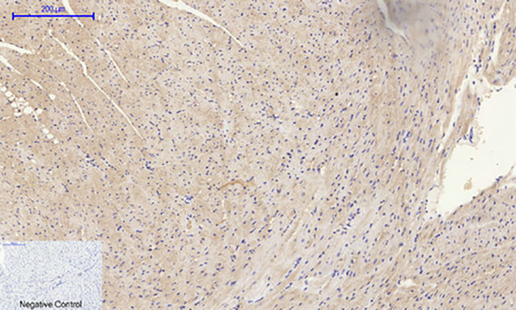 Fig.5. Immunohistochemical analysis of paraffin-embedded mouse heart tissue. 1, MMP-2 Polyclonal Antibody was diluted at 1:200 (4°C, overnight). 2, Sodium citrate pH 6.0 was used for antibody retrieval (>98°C, 20min). 3, secondary antibody was diluted at 1:200 (room temperature, 30min). Negative control was used by secondary antibody only.