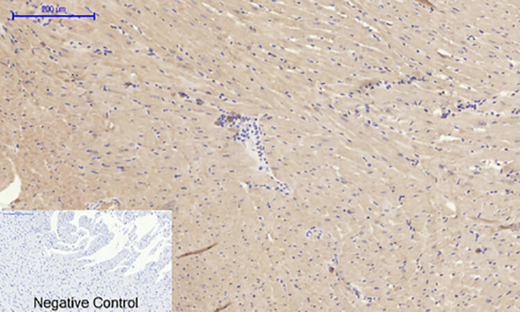 Fig.6. Immunohistochemical analysis of paraffin-embedded rat heart tissue. 1, MMP-2 Polyclonal Antibody was diluted at 1:200 (4°C, overnight). 2, Sodium citrate pH 6.0 was used for antibody retrieval (>98°C, 20min). 3, secondary antibody was diluted at 1:200 (room temperature, 30min). Negative control was used by secondary antibody only.