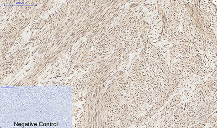 Fig.4. Immunohistochemical analysis of paraffin-embedded human uterus tissue. 1, MyD88 Polyclonal Antibody was diluted at 1:200 (4°C, overnight). 2, Sodium citrate pH 6.0 was used for antibody retrieval (>98°C, 20min). 3, secondary antibody was diluted at 1:200 (room temperature, 30min). Negative control was used by secondary antibody only.
