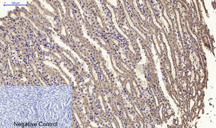 Fig.5. Immunohistochemical analysis of paraffin-embedded mouse kidney tissue. 1, MyD88 Polyclonal Antibody was diluted at 1:200 (4°C, overnight). 2, Sodium citrate pH 6.0 was used for antibody retrieval (>98°C, 20min). 3, secondary antibody was diluted at 1:200 (room temperature, 30min). Negative control was used by secondary antibody only.