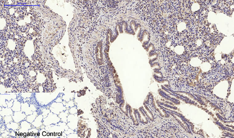 Fig.6. Immunohistochemical analysis of paraffin-embedded rat lung tissue. 1, MyD88 Polyclonal Antibody was diluted at 1:200 (4°C, overnight). 2, Sodium citrate pH 6.0 was used for antibody retrieval (>98°C, 20min). 3, secondary antibody was diluted at 1:200 (room temperature, 30min). Negative control was used by secondary antibody only.