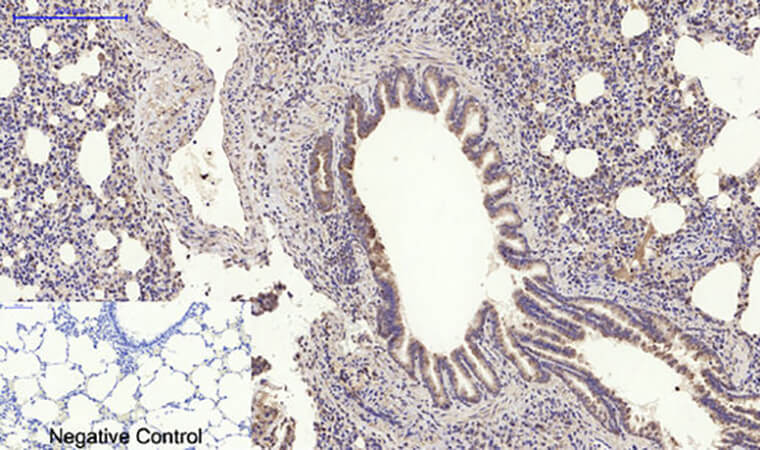 Fig.6. Immunohistochemical analysis of paraffin-embedded rat lung tissue. 1, MyD88 Polyclonal Antibody was diluted at 1:200 (4°C, overnight). 2, Sodium citrate pH 6.0 was used for antibody retrieval (>98°C, 20min). 3, secondary antibody was diluted at 1:200 (room temperature, 30min). Negative control was used by secondary antibody only.