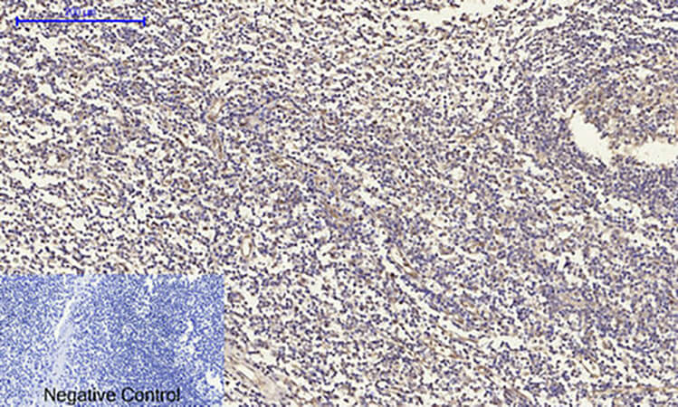 Fig.4. Immunohistochemical analysis of paraffin-embedded human tonsil tissue. 1, OPG Polyclonal Antibody was diluted at 1:200 (4°C, overnight). 2, Sodium citrate pH 6.0 was used for antibody retrieval (>98°C, 20min). 3, secondary antibody was diluted at 1:200 (room temperature, 30min). Negative control was used by secondary antibody only.