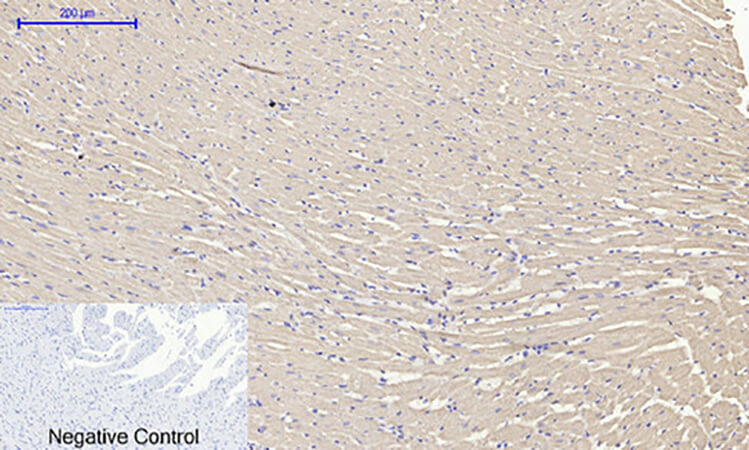 Fig.6. Immunohistochemical analysis of paraffin-embedded rat heart tissue. 1, OPG Polyclonal Antibody was diluted at 1:200 (4°C, overnight). 2, Sodium citrate pH 6.0 was used for antibody retrieval (>98°C, 20min). 3, secondary antibody was diluted at 1:200 (room temperature, 30min). Negative control was used by secondary antibody only.