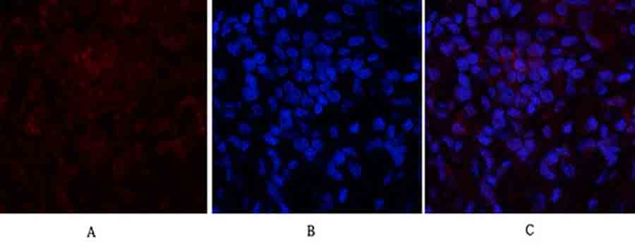 Fig.3. Immunofluorescence analysis of rat lung tissue. 1, p21 Polyclonal Antibody (red) was diluted at 1:200 (4°C, overnight). 2, Cy3 Labeled secondary antibody was diluted at 1:300 (room temperature, 50min). 3, Picture B: DAPI (blue) 10min. Picture A: Target. Picture B: DAPI. Picture C: merge of A+B.
