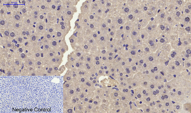 Fig.4. Immunohistochemical analysis of paraffin-embedded mouse liver tissue. 1, p21 Polyclonal Antibody was diluted at 1:200 (4°C, overnight). 2, Sodium citrate pH 6.0 was used for antibody retrieval (>98°C, 20min). 3, secondary antibody was diluted at 1:200 (room temperature, 30min). Negative control was used by secondary antibody only.