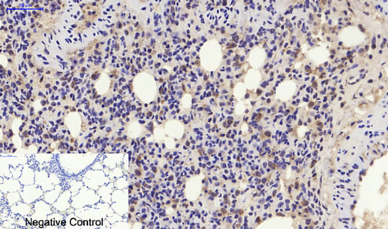 Fig.5. Immunohistochemical analysis of paraffin-embedded rat lung tissue. 1, p21 Polyclonal Antibody was diluted at 1:200 (4°C, overnight). 2, Sodium citrate pH 6.0 was used for antibody retrieval (>98°C, 20min). 3, secondary antibody was diluted at 1:200 (room temperature, 30min). Negative control was used by secondary antibody only.