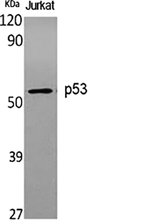 Fig.1. Western Blot analysis of various cells using p53 Polyclonal Antibody diluted at 1:1000.