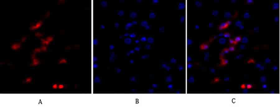 Fig.2. Immunofluorescence analysis of human liver tissue. 1, p53 Polyclonal Antibody (red) was diluted at 1:200 (4°C, overnight). 2, Cy3 Labeled secondary antibody was diluted at 1:300 (room temperature, 50min). 3, Picture B: DAPI (blue) 10min. Picture A: Target. Picture B: DAPI. Picture C: merge of A+B.