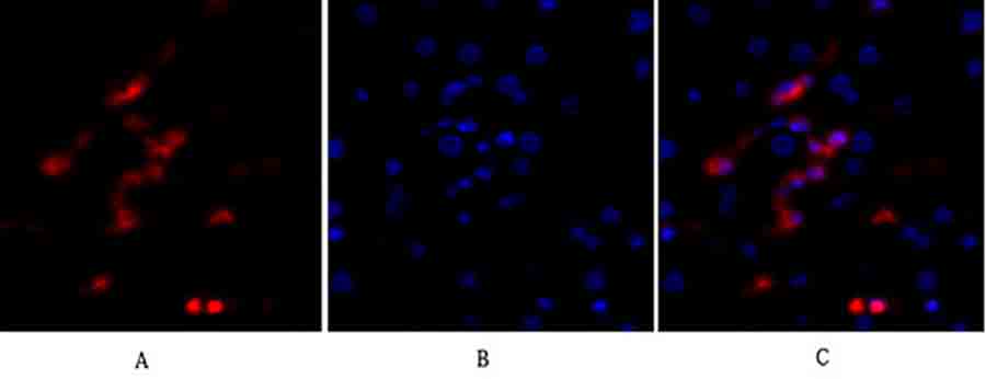 Fig.2. Immunofluorescence analysis of human liver tissue. 1, p53 Polyclonal Antibody (red) was diluted at 1:200 (4°C, overnight). 2, Cy3 Labeled secondary antibody was diluted at 1:300 (room temperature, 50min). 3, Picture B: DAPI (blue) 10min. Picture A: Target. Picture B: DAPI. Picture C: merge of A+B.