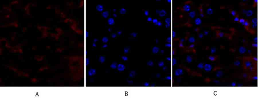 Fig.3. Immunofluorescence analysis of mouse liver tissue. 1, p53 Polyclonal Antibody (red) was diluted at 1:200 (4°C, overnight). 2, Cy3 Labeled secondary antibody was diluted at 1:300 (room temperature, 50min). 3, Picture B: DAPI (blue) 10min. Picture A: Target. Picture B: DAPI. Picture C: merge of A+B.