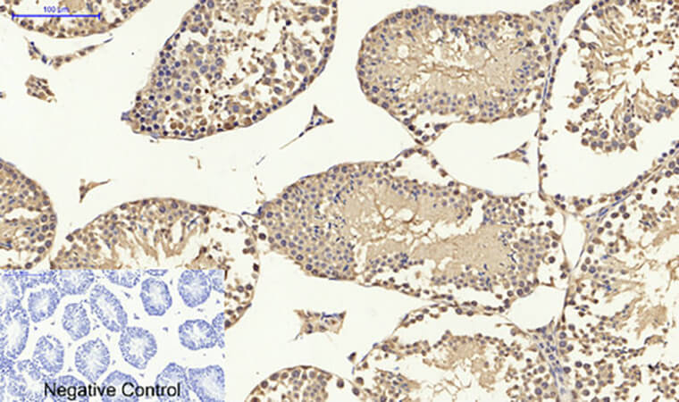 Fig.5. Immunohistochemical analysis of paraffin-embedded mouse testis tissue. 1, p53 Polyclonal Antibody was diluted at 1:200 (4°C, overnight). 2, Sodium citrate pH 6.0 was used for antibody retrieval (>98°C, 20min). 3, secondary antibody was diluted at 1:200 (room temperature, 30min). Negative control was used by secondary antibody only.