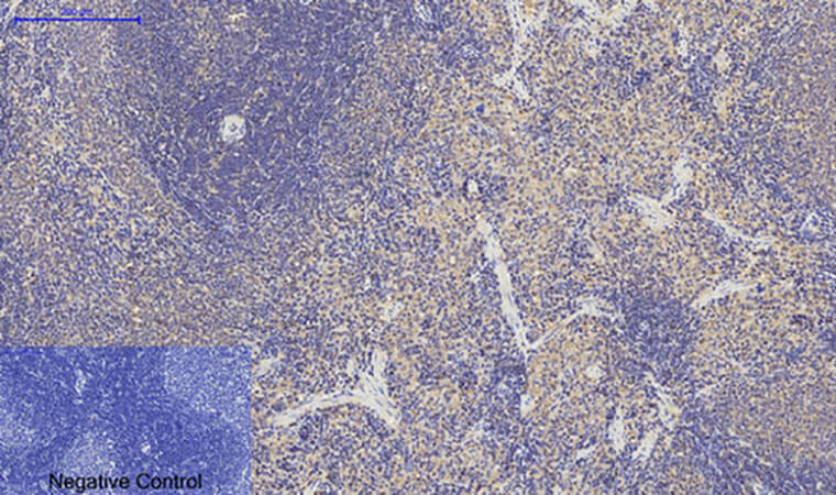 Fig.6. Immunohistochemical analysis of paraffin-embedded rat spleen tissue. 1, p53 Polyclonal Antibody was diluted at 1:200 (4°C, overnight). 2, Sodium citrate pH 6.0 was used for antibody retrieval (>98°C, 20min). 3, secondary antibody was diluted at 1:200 (room temperature, 30min). Negative control was used by secondary antibody only.