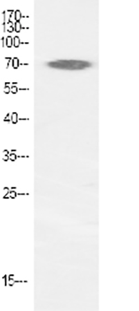 Fig.1. Western Blot analysis of various cells using p70 S6 kinase α Polyclonal Antibody diluted at 1:1000.