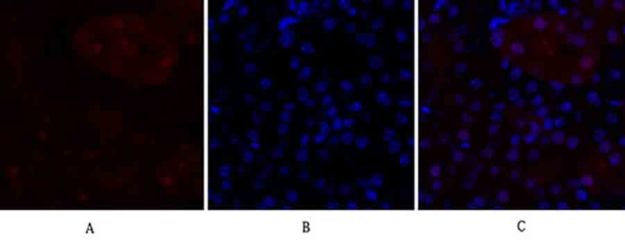 Fig.2. Immunofluorescence analysis of mouse kidney tissue. 1, p70 S6 kinase α Polyclonal Antibody (red) was diluted at 1:200 (4°C, overnight). 2, Cy3 Labeled secondary antibody was diluted at 1:300 (room temperature, 50min). 3, Picture B: DAPI (blue) 10min. Picture A: Target. Picture B: DAPI. Picture C: merge of A+B.
