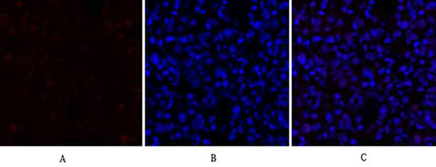 Fig.3. Immunofluorescence analysis of rat lung tissue. 1, p70 S6 kinase α Polyclonal Antibody (red) was diluted at 1:200 (4°C, overnight). 2, Cy3 Labeled secondary antibody was diluted at 1:300 (room temperature, 50min). 3, Picture B: DAPI (blue) 10min. Picture A: Target. Picture B: DAPI. Picture C: merge of A+B.