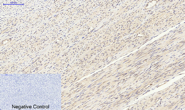 Fig.4. Immunohistochemical analysis of paraffin-embedded human uterus tissue. 1, p70 S6 kinase α Polyclonal Antibody was diluted at 1:200 (4°C, overnight). 2, Sodium citrate pH 6.0 was used for antibody retrieval (>98°C, 20min). 3, secondary antibody was diluted at 1:200 (room temperature, 30min). Negative control was used by secondary antibody only.