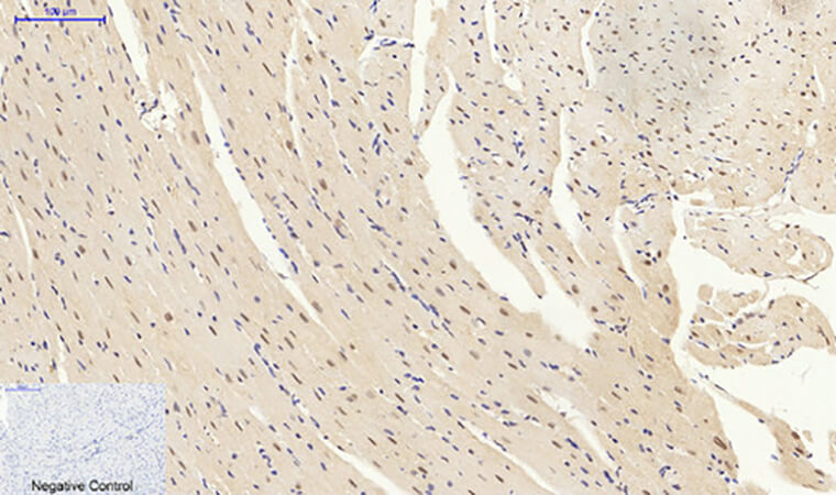 Fig.5. Immunohistochemical analysis of paraffin-embedded mouse heart tissue. 1, p70 S6 kinase α Polyclonal Antibody was diluted at 1:200 (4°C, overnight). 2, Sodium citrate pH 6.0 was used for antibody retrieval (>98°C, 20min). 3, secondary antibody was diluted at 1:200 (room temperature, 30min). Negative control was used by secondary antibody only.