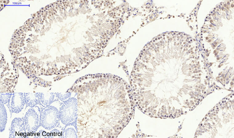 Fig.6. Immunohistochemical analysis of paraffin-embedded rat testis tissue. 1, p70 S6 kinase α Polyclonal Antibody was diluted at 1:200 (4°C, overnight). 2, Sodium citrate pH 6.0 was used for antibody retrieval (>98°C, 20min). 3, secondary antibody was diluted at 1:200 (room temperature, 30min). Negative control was used by secondary antibody only.