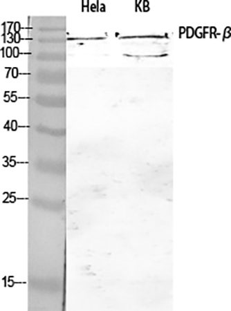 Fig.1. Western Blot analysis of Hela (1), KB (2), diluted at 1:1000.
