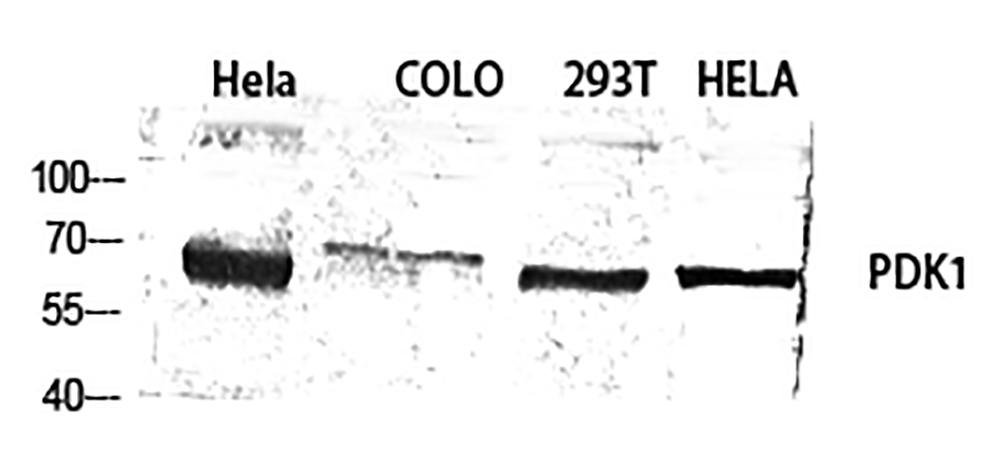Fig.1. Western Blot analysis of Hela (1), Colo (2), 293T (3), Hela (4), diluted at 1:1000.